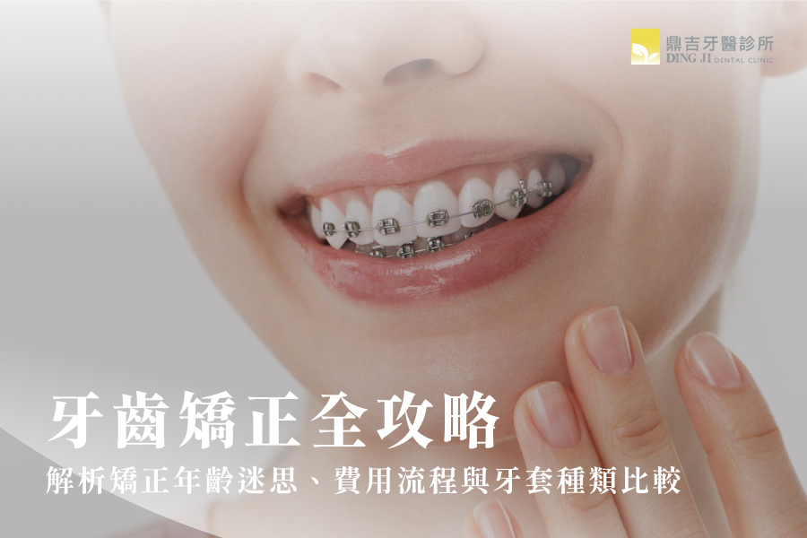 牙齒矯正全攻略：解析矯正年齡迷思、費用流程與牙套種類比較