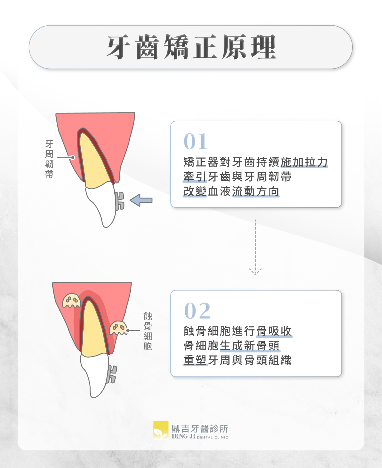 牙齒矯正原理