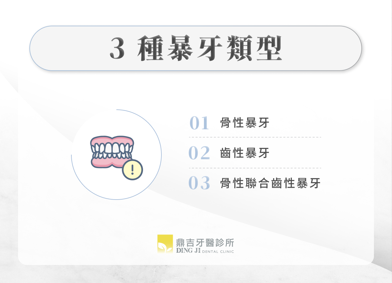 3 種暴牙類型