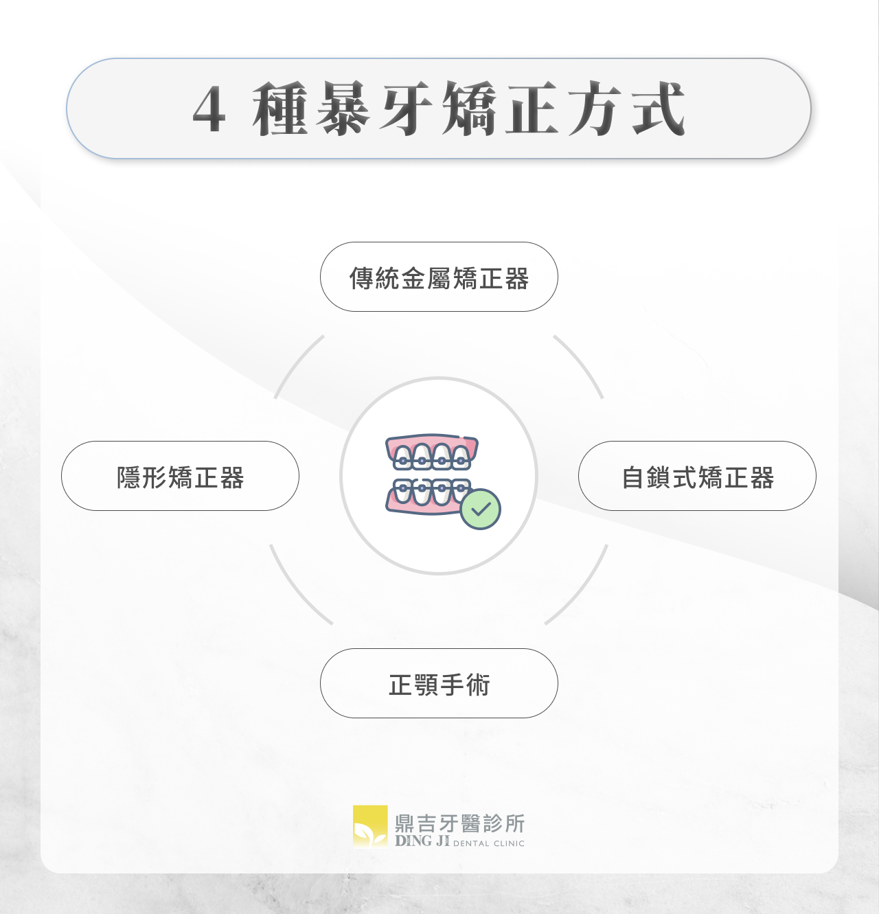 4 種暴牙矯正方式