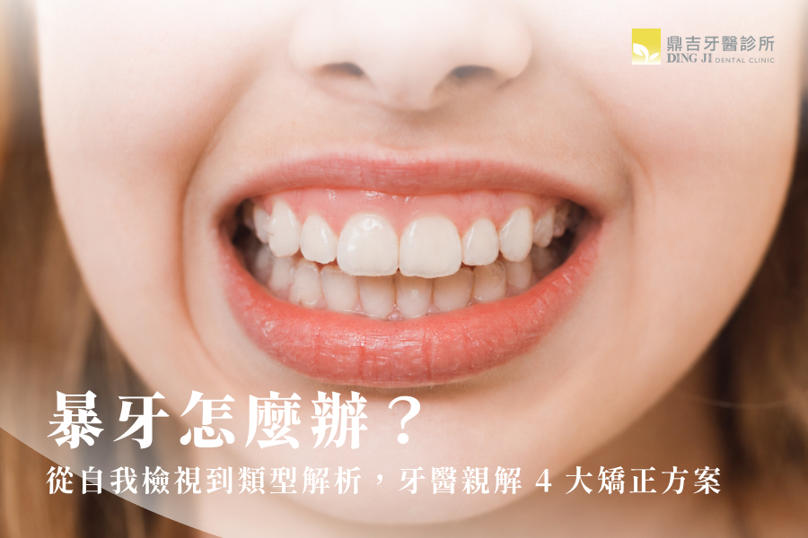 暴牙怎麼辦？從自我檢視到類型解析，牙醫親解4大矯正方案
